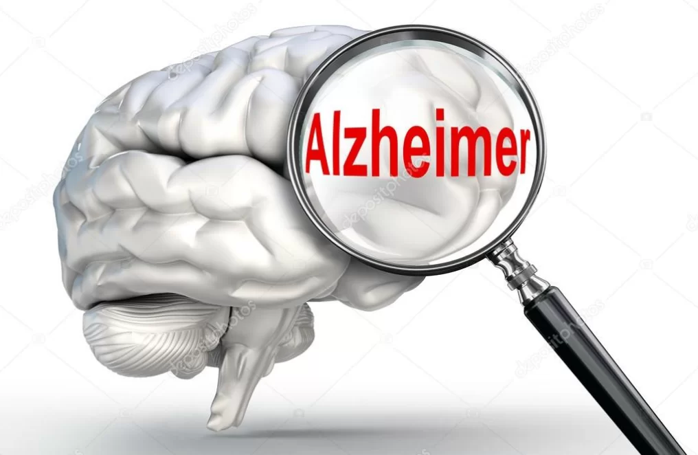 entendendo o alzheimer